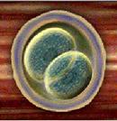 Genesis IVF - Pregnancy Test in Embryo Transfer