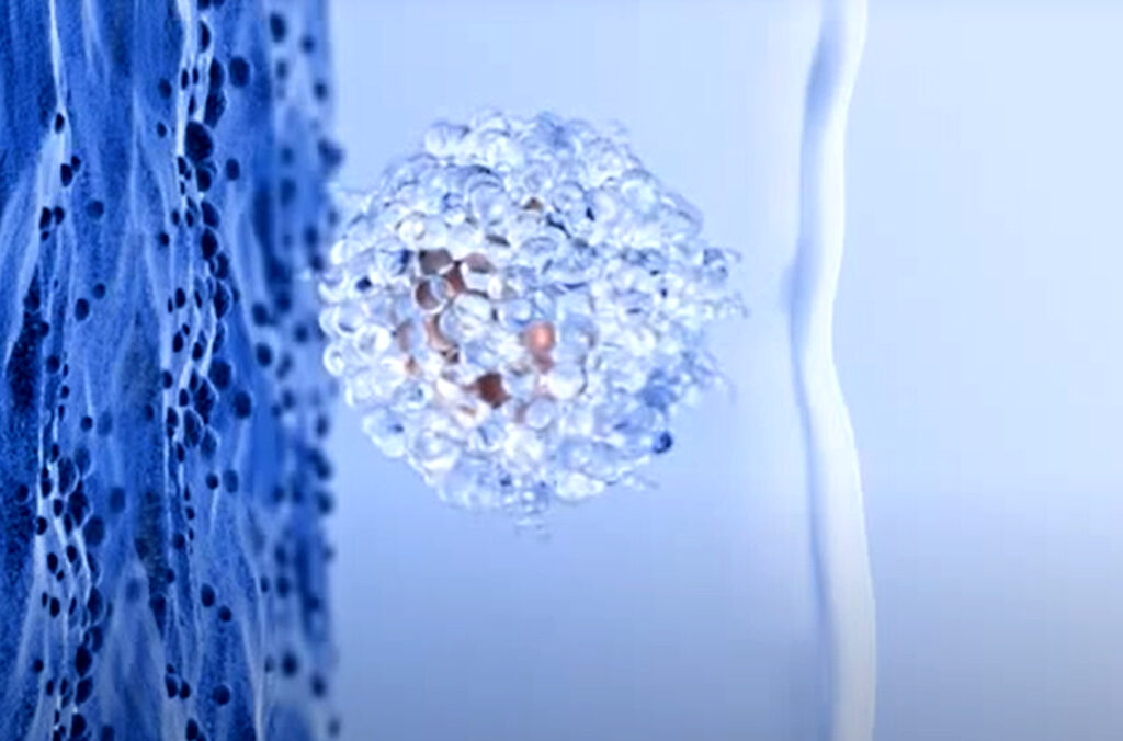 EmbryoGlue